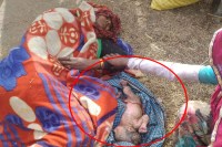  खुले में लेटी प्रसूता व नवजात