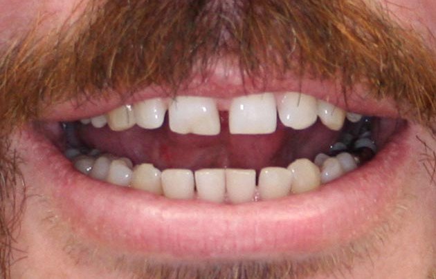 teeth