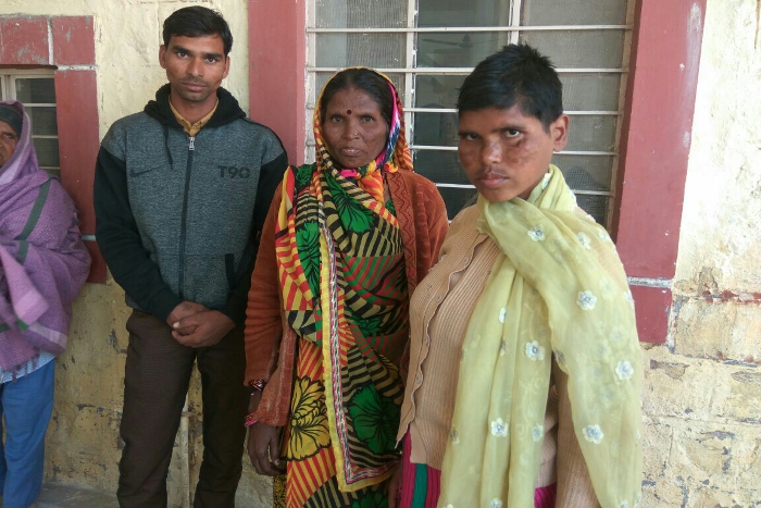 विमंदित युवती