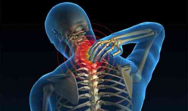  neck pain
