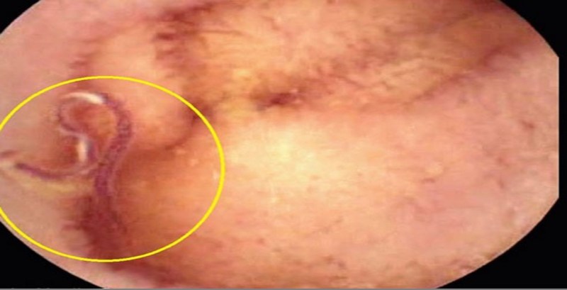 stomach, stomach warm, abdomen pain