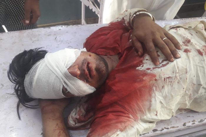 खूनी संघर्ष में घायल