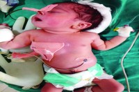 जब उसे अस्पताल लाया गया तो उसकी सांस अटकने लगी थी