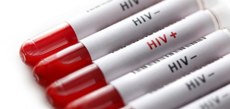 HIV-positive
