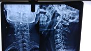 Neck bone