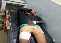 Naresh bhati Encounter