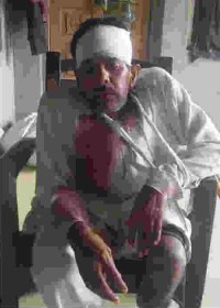 handicapped, beat, thana jasrana, spra mp singh, sp mahendra pratap singh, thana jasrana police, firozabad police, up police, firing, up crime news in hindi, crime news firozabad 