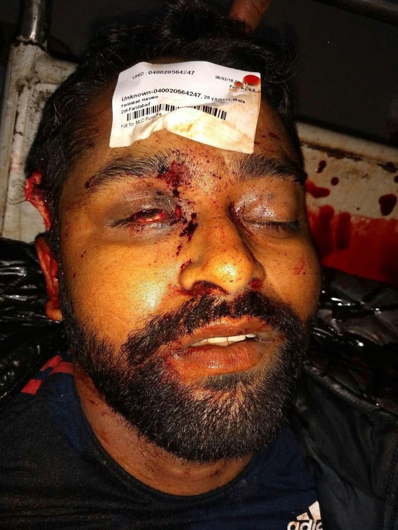 Police encounter most wanted gangster in faridabad