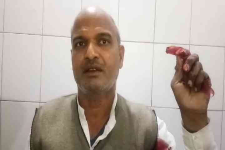 BREAKING: गाजीपुर में जयशंकर राजभर को रोककर मारी गयी गोली, गंभीर हालत में
वाराणसी रेफर