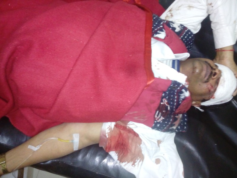 Due to returning from the temple the car of a visitor turned upside do, news in hindi, mp news, dabra news