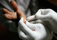 Blood Sample