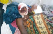 Injures Villager