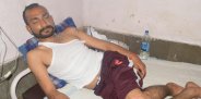 satna Acid Attack