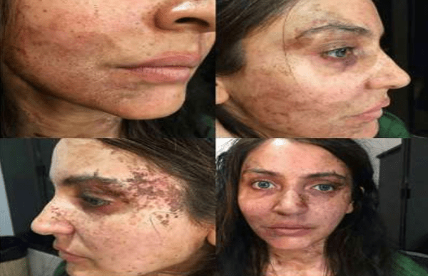 परी के लिए ऐसे दिया गया अनुष्का को खौफनाक लुक