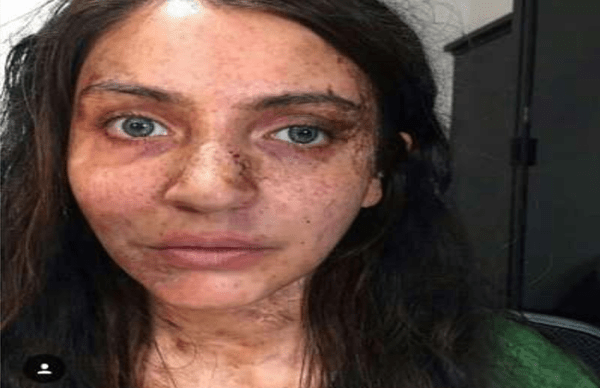 परी के लिए ऐसे दिया गया अनुष्का को खौफनाक लुक