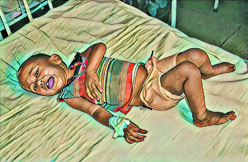 malnutrition