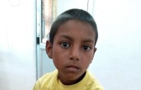 kidney stone treatment