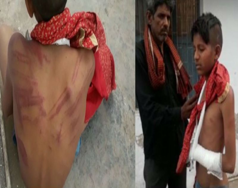 Teacher brutally beaten student