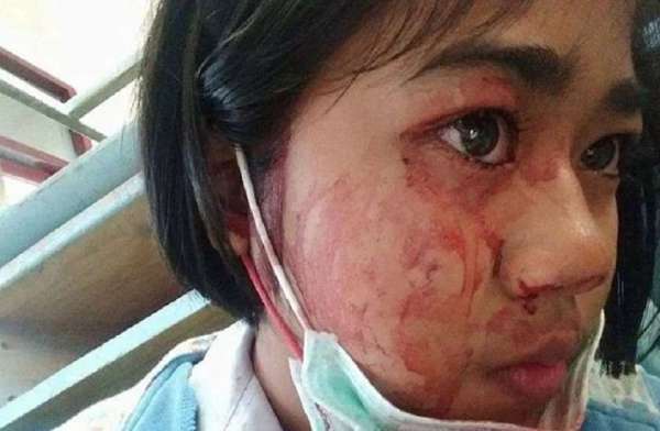 Thailand,doctors,girl,blood,health condition,Bloodshed,Strange disease,wound,Bleeding,