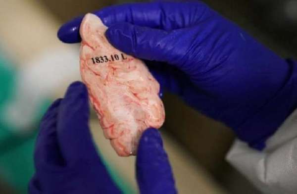 diseases,Britain,research,human brain,lab,preserve,parts of the human brain,