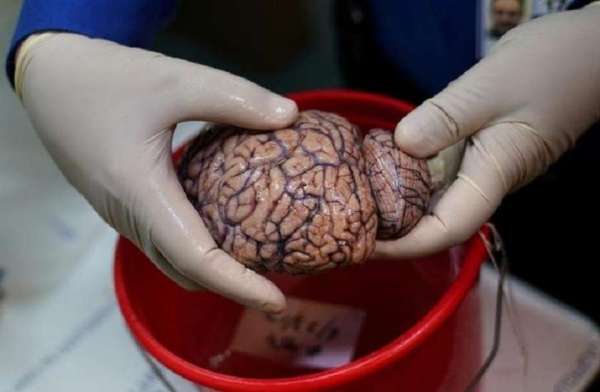 diseases,Britain,research,human brain,lab,preserve,parts of the human brain,