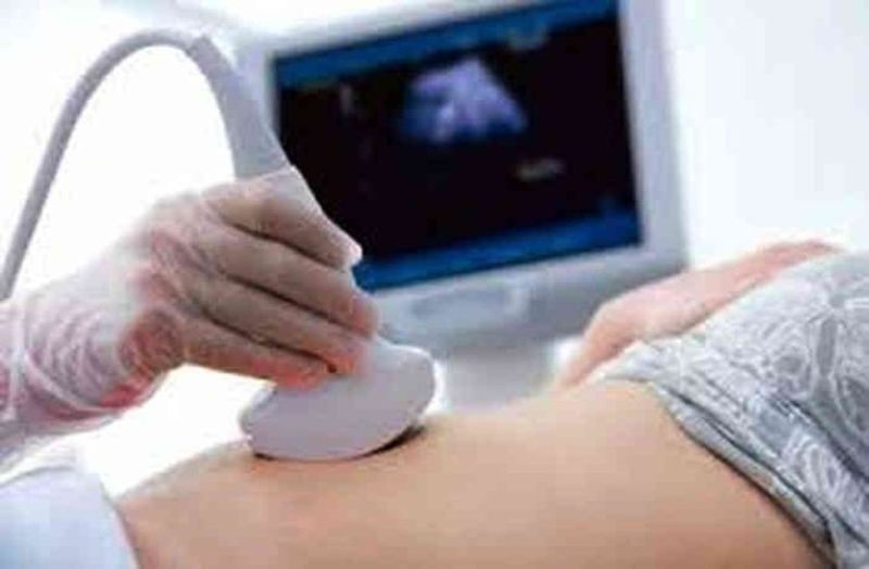 sonography