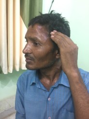 amazing operation done by mumbai doctors