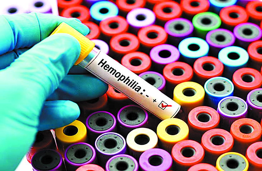hemophilia patients
