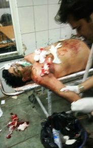देररात बदमाशों ने वारदात को दिया अंजाम, पुलिस ने मामला दर्ज कर आरोपियों की गिरफ्तारी के कर रही प्रयास