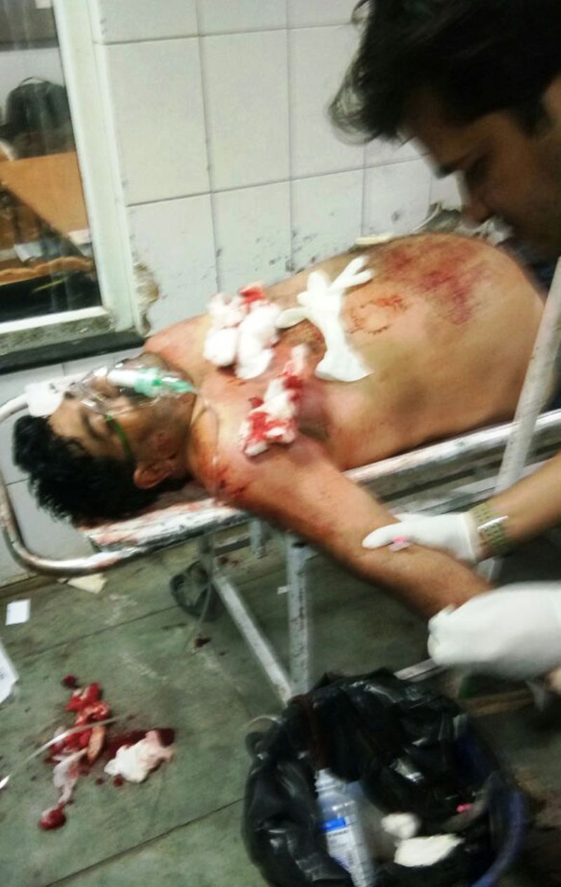 देररात बदमाशों ने वारदात को दिया अंजाम, पुलिस ने मामला दर्ज कर आरोपियों की गिरफ्तारी के कर रही प्रयास