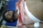 Injured boyfriend