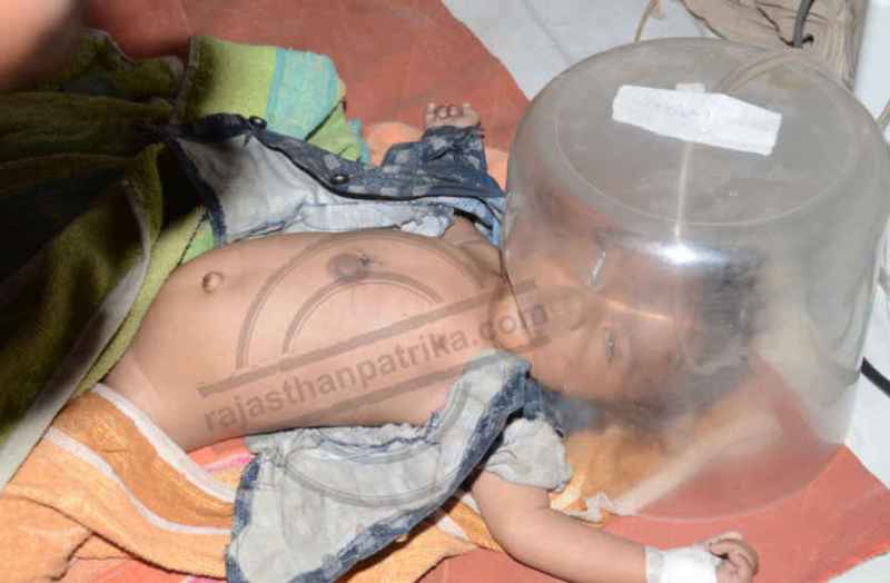 Bhilwara, bhilwara news, neonatal death burning hot bars in bhilwara, Latest news in bhilwara, Bhilwara News in hindi, Hindi News in bhilwara, Latest hindi news in bhilwara