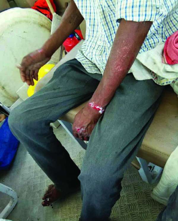 Rajsamand,Rajsamand news,Rajsamand Hindi news,Rajsamand local news,rajsamand latest news,rajsamand news in hindi,rajsamand latest hindi news,rajsamand latest hindi news rajsamand,Latest News rajsamand,Latest hindi news rajsamand,