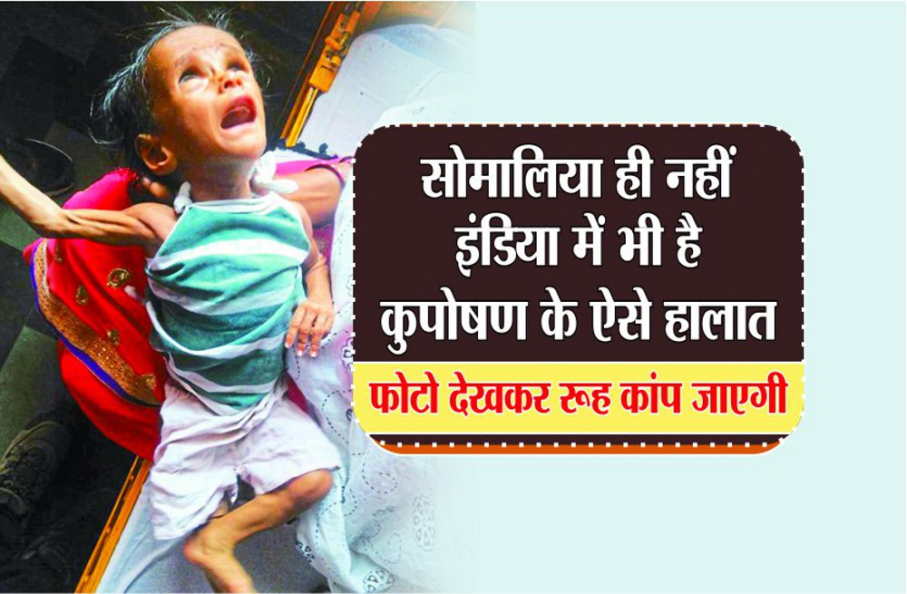 10 departments to end malnutrition