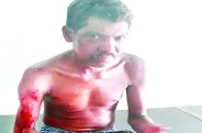 जैसे-तैसे भाग कर अपनी जान बचाई