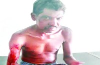 जैसे-तैसे भाग कर अपनी जान बचाई