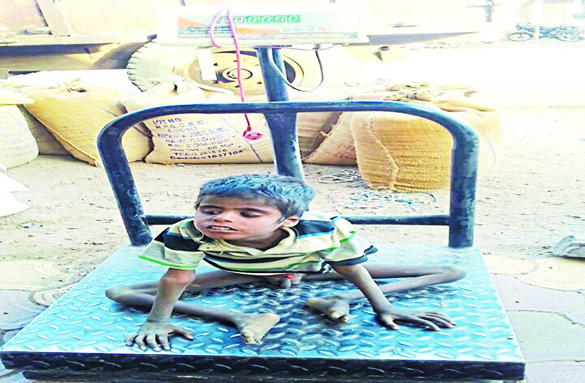 malnutrition, patrika news, vidisha patrika, patrika bhopal, child, 