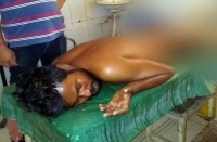 ऐल्डरमैन के भाई ने युवक को खौलते तेल की कढ़ाई में फेंका, कमर के नीचे का हिस्सा 50 फीसदी जला