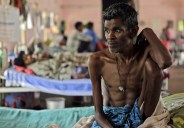 TB patients