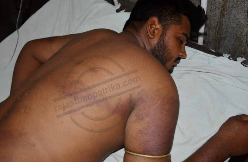 Beaten the guards detainee in prison in bhilwara
