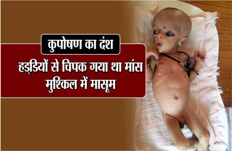 kuposhan ka dansh, Haddiyon se chipak gaya tha Mans