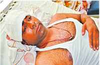 Attack on water park operative couple in bhilwara