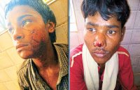 18 people injured in leopard attack in 8 villages of Panna