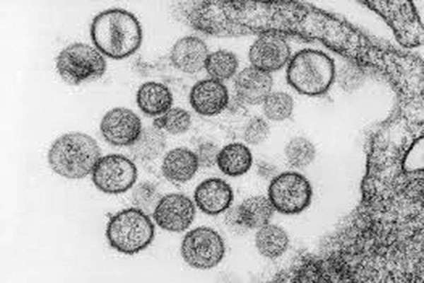 hanta virus