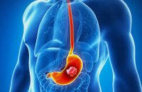 पेट का कैंसर