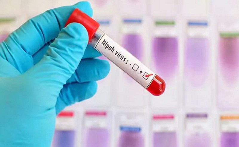 निपाह वायरस
