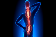 Osteoporosis