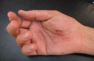hand