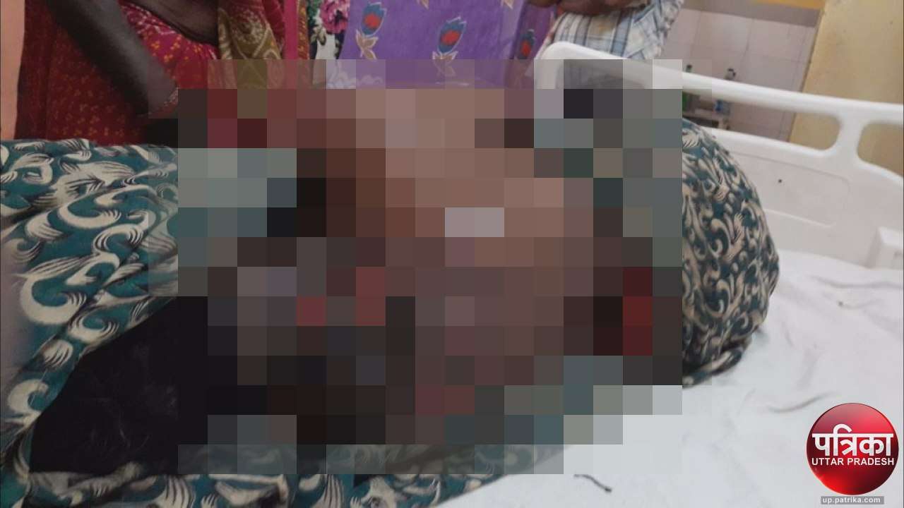 woman burn by hot iron rod then trying to Bury