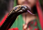 Snake bite